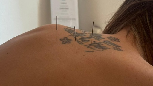 Acupuncture : première séance